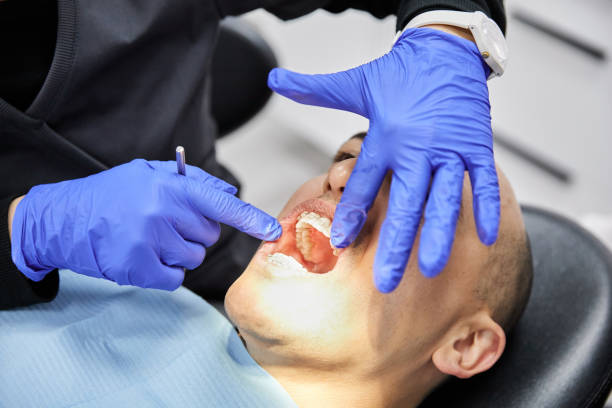Best Emergency Tooth Extraction in Indialantic, FL